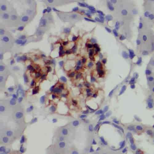 Anti-PYK2 antibody