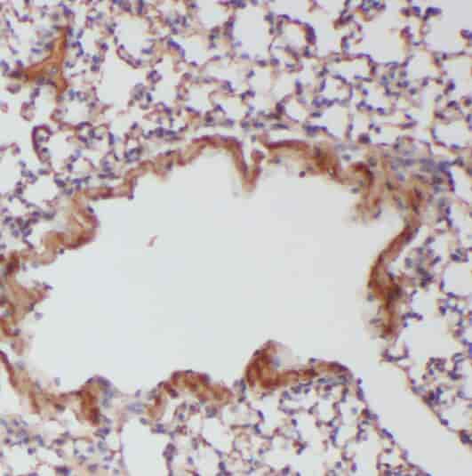 Anti-RABGGTA antibody