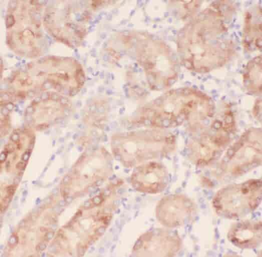 Anti-RABL2A antibody