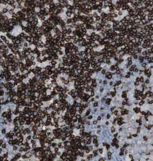 Anti-RAD1 antibody