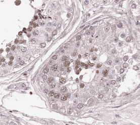 Anti-RAD51 antibody