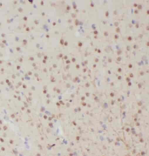 Anti-RALYL antibody