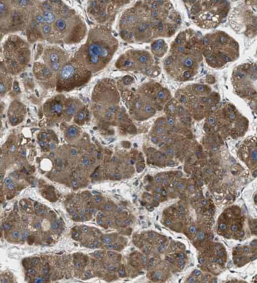Anti-RAPH1 antibody