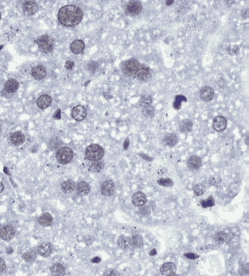 Anti-RBBP5 antibody