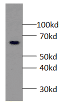 Anti-RUNX2 antibody
