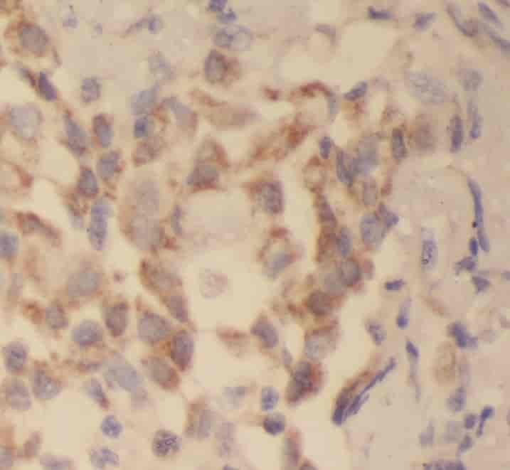 Anti-S100A10 antibody