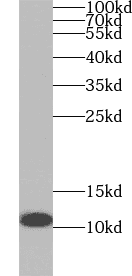 Anti-S100A3 antibody