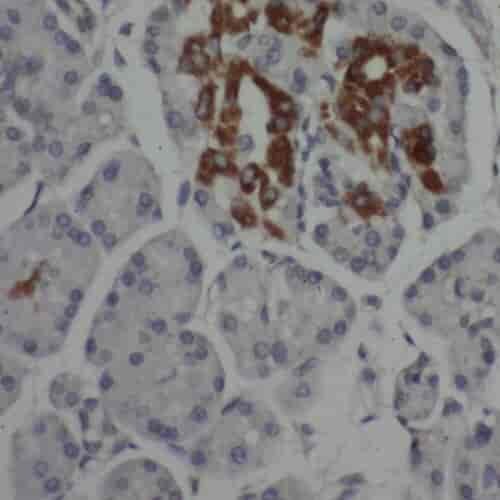 Anti-SAP130 antibody