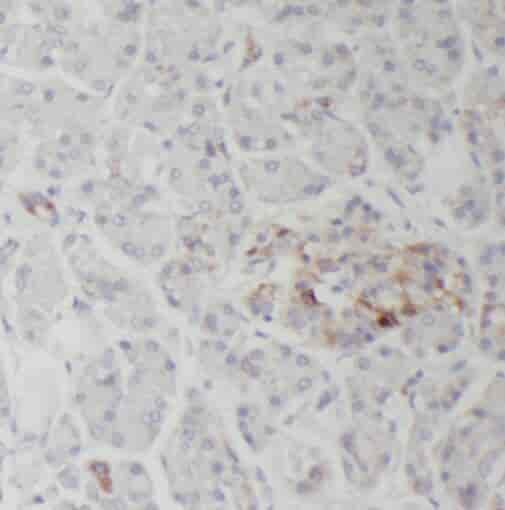 Anti-SERCA3 antibody