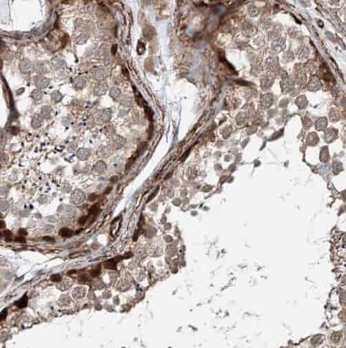 Anti-SF4 antibody