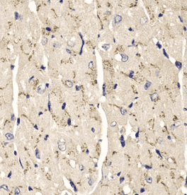 Anti-SFRP2 antibody