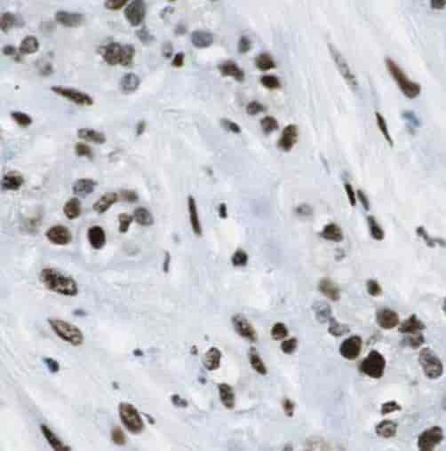 Anti-SFRS17A antibody