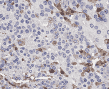 Anti-SLC16A3 antibody