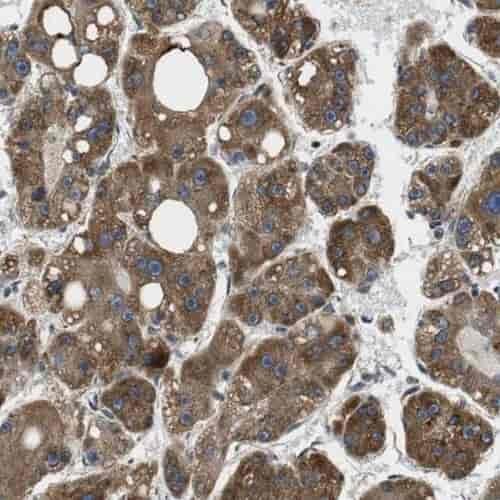 Anti-SLC25A2 antibody