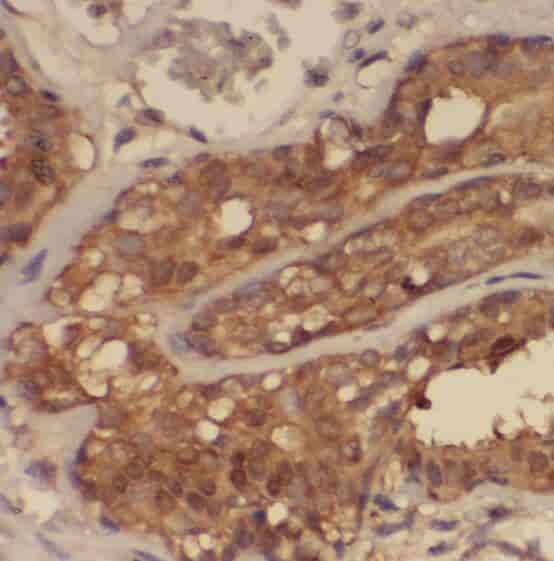 Anti-SNRPF antibody