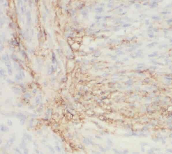 Anti-SNX17 antibody
