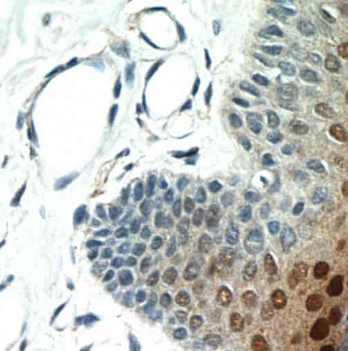 Anti-SP6 antibody