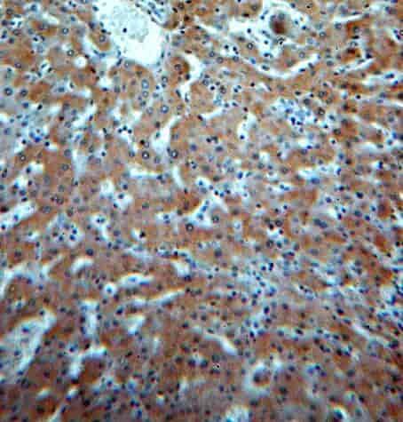 Anti-SPP antibody