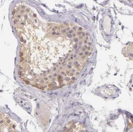 Anti-SPZ1 antibody