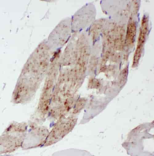 Anti-ST3GAL5 antibody