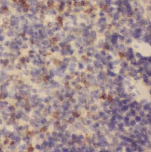 Anti-STIM2 antibody