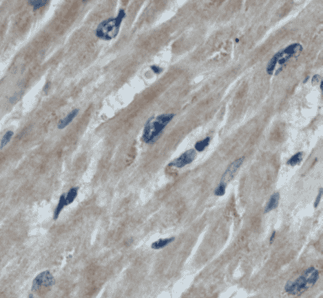 Anti-STUB1 antibody