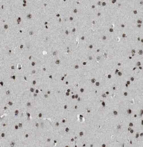 Anti-STXBP1 antibody