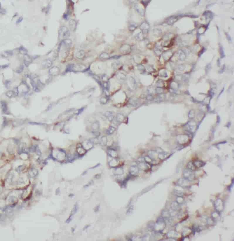 Anti-Seladin 1 antibody