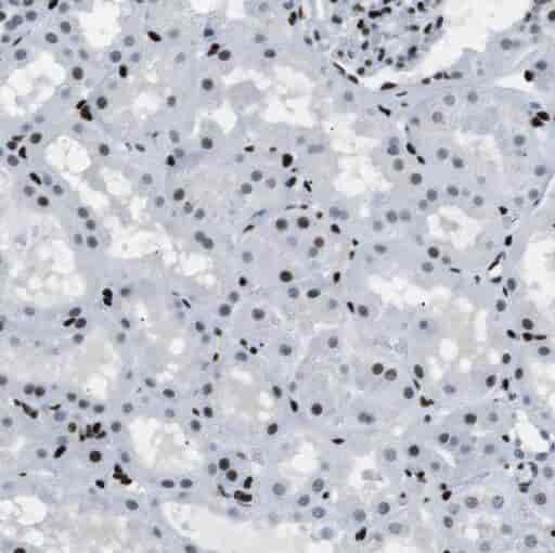 Anti-Semenogelin-1 antibody