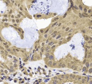 Anti-TERF2IP antibody