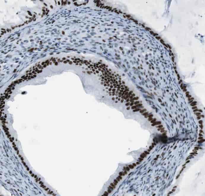 Anti-THRAP3 antibody
