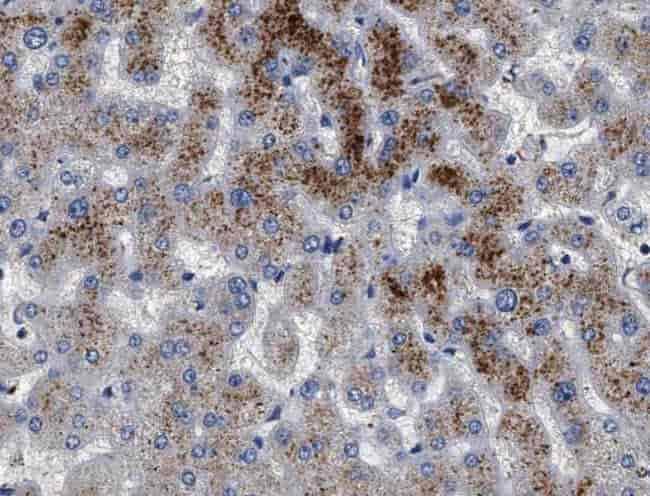 Anti-TIMM44 antibody