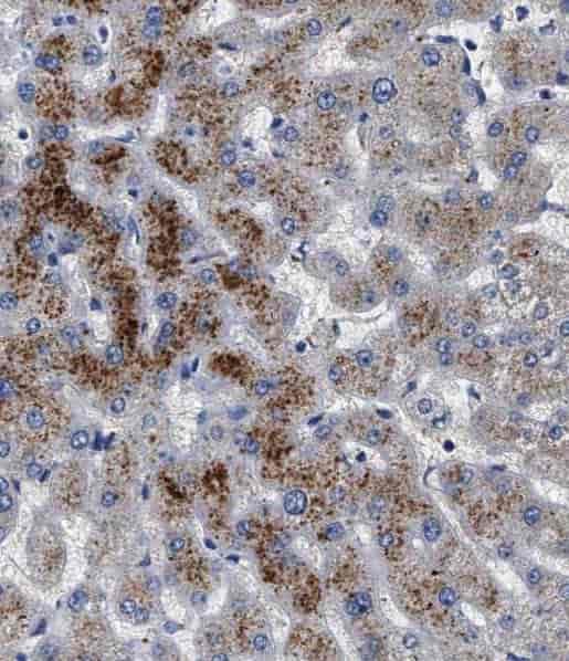 Anti-TIMM50 antibody