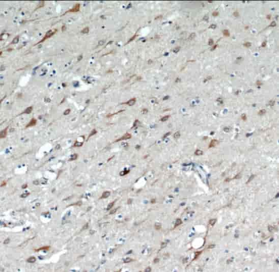 Anti-TMX4 antibody