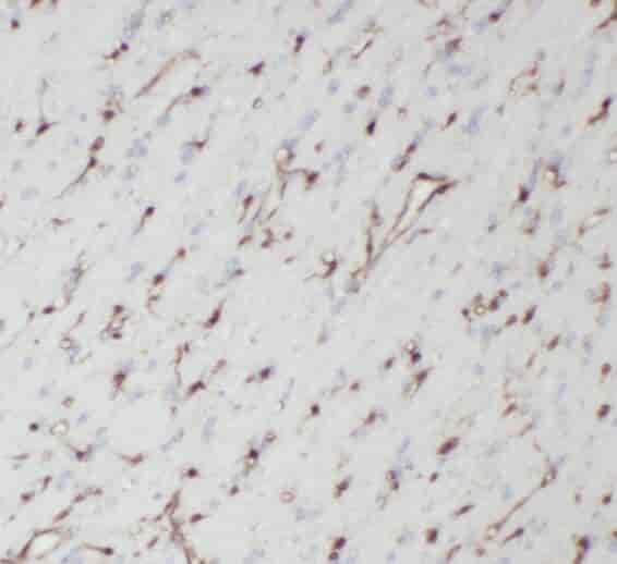 Anti-TPPP antibody