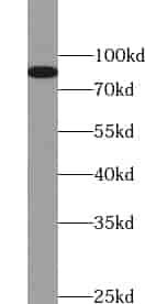 Anti-TRIM37 antibody