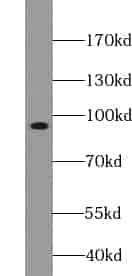 Anti-TRIM9 antibody