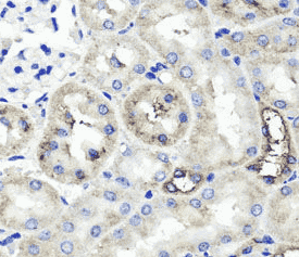 Anti-TSG-6 antibody