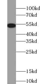 Anti-TSP50 antibody