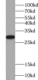 Anti-TSPAN12 antibody
