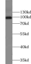 Anti-TSR1 antibody