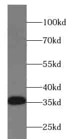 Anti-TTC35 antibody
