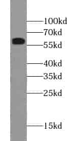 Anti-TUB antibody