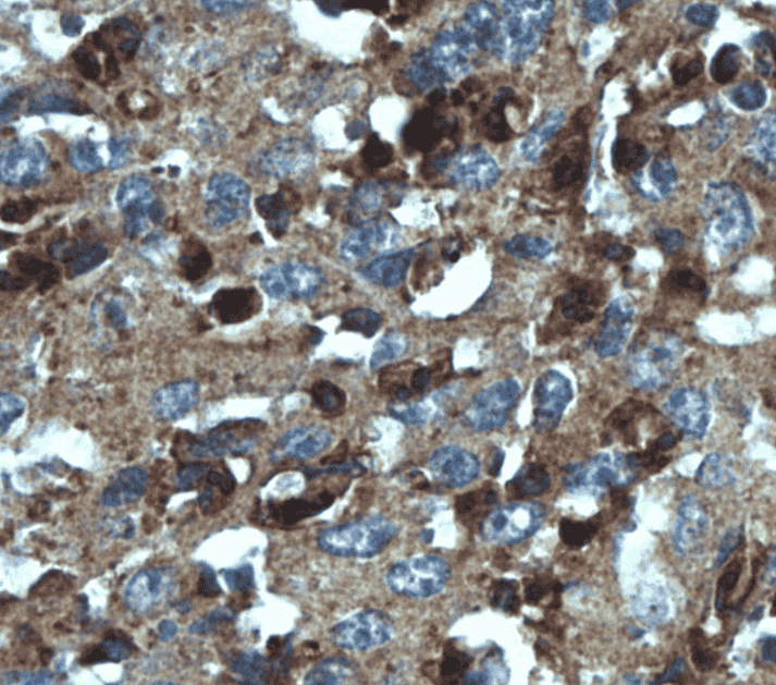 Anti-TXNDC16 antibody