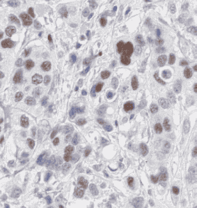 Anti-UAP56 antibody