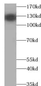 Anti-UBN1-Specific antibody