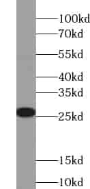Anti-UMP/CMP kinase antibody