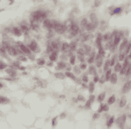 Anti-UMPS antibody