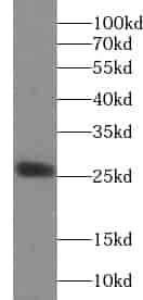 Anti-UQCRFS1 antibody