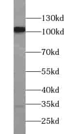 Anti-USP10 antibody